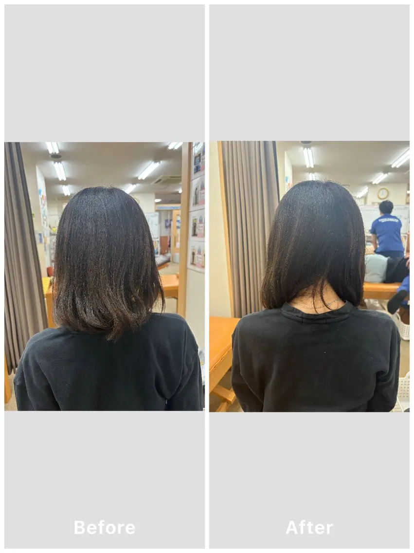 美容鍼×小顔矯正× 美容整体/小林幸司のエステ・リラクイメージ