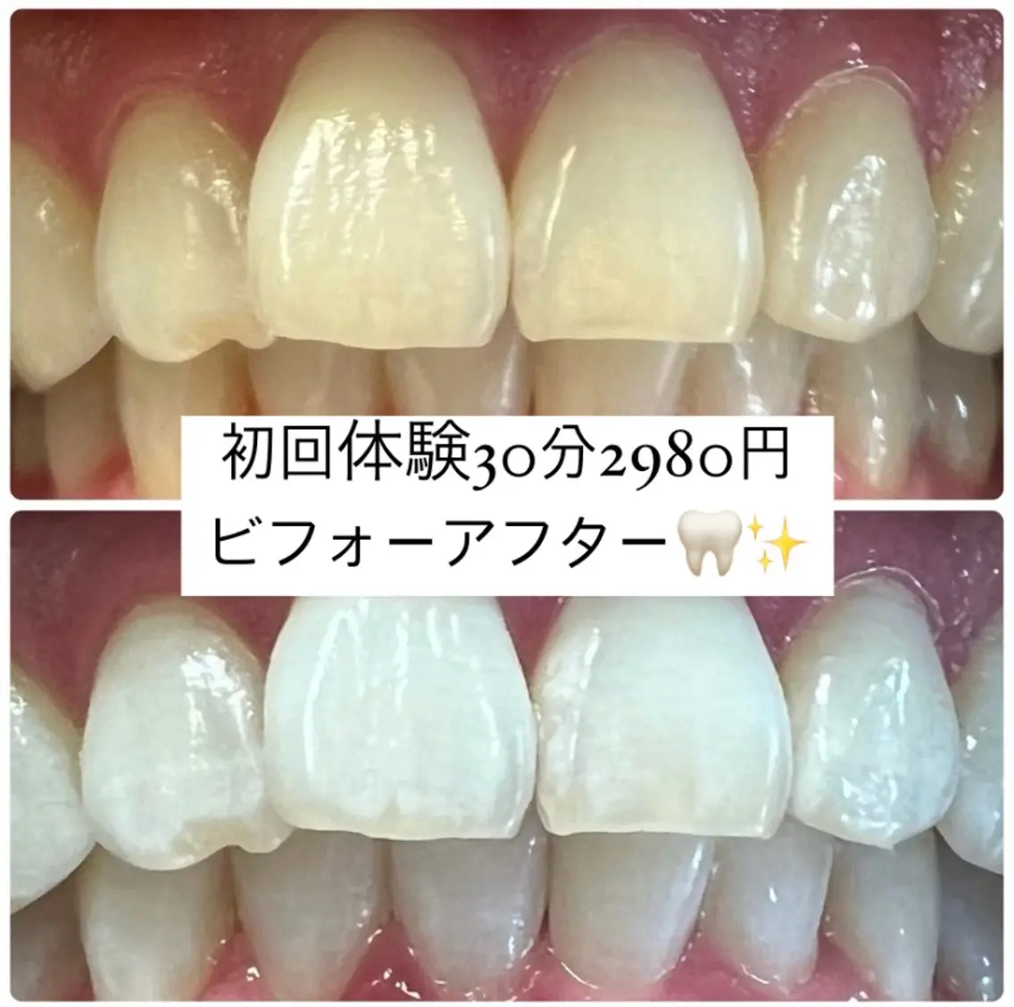 その他 ホワイトニングルーム 横浜店のその他イメージ