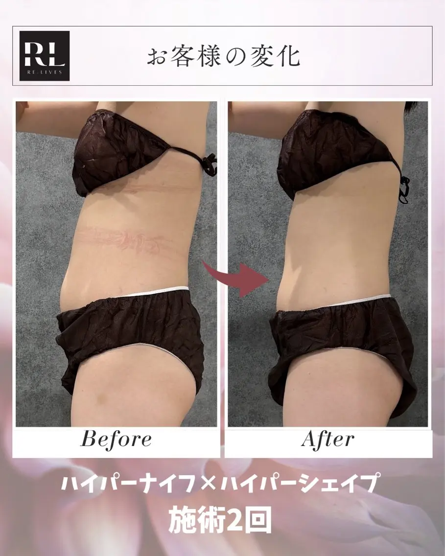 エステ 【痩身&美肌】 Re:Lives金町のエステ・リラクイメージ