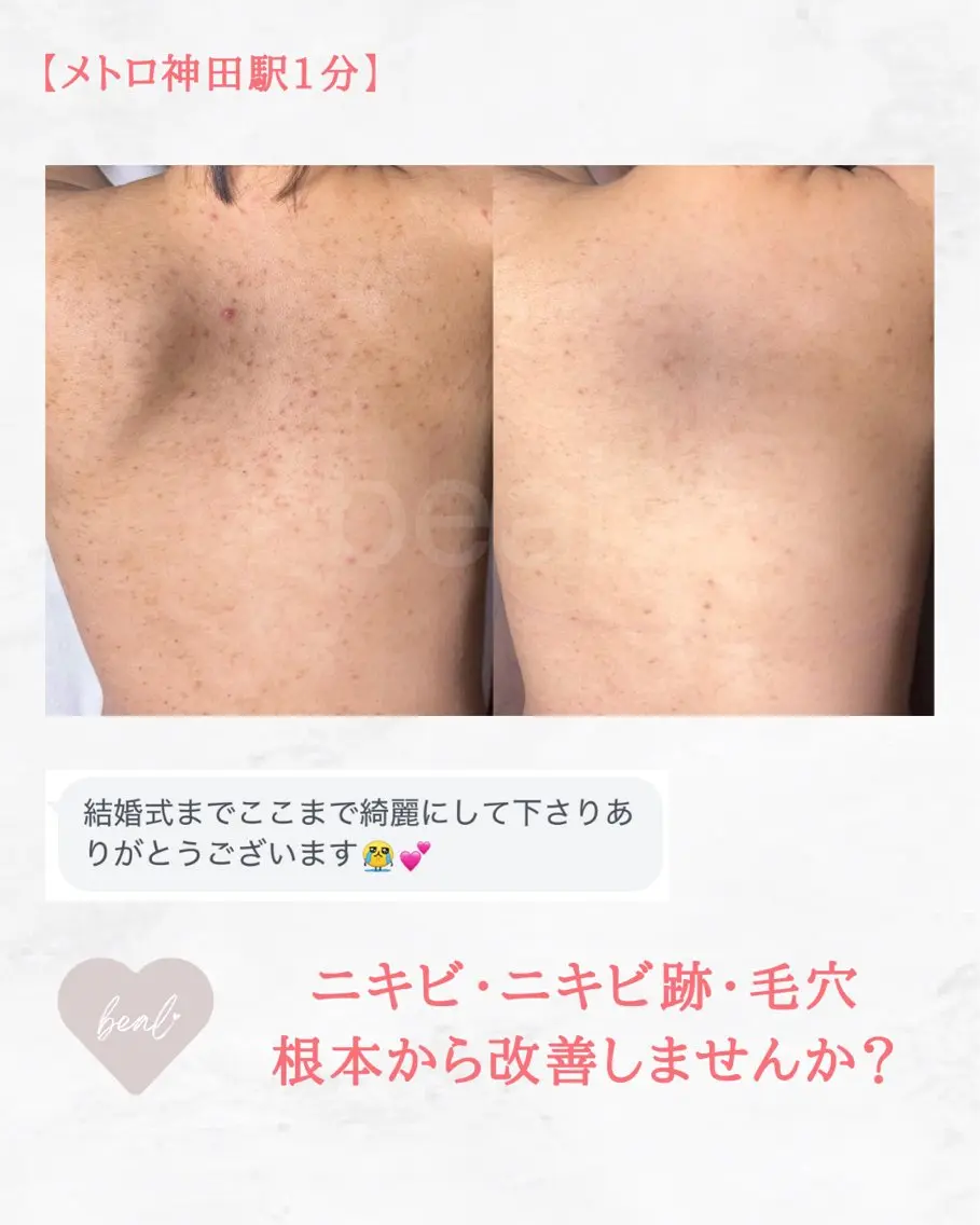 小顔/毛穴/ニキビ salon bealのエステ・リラクイメージ