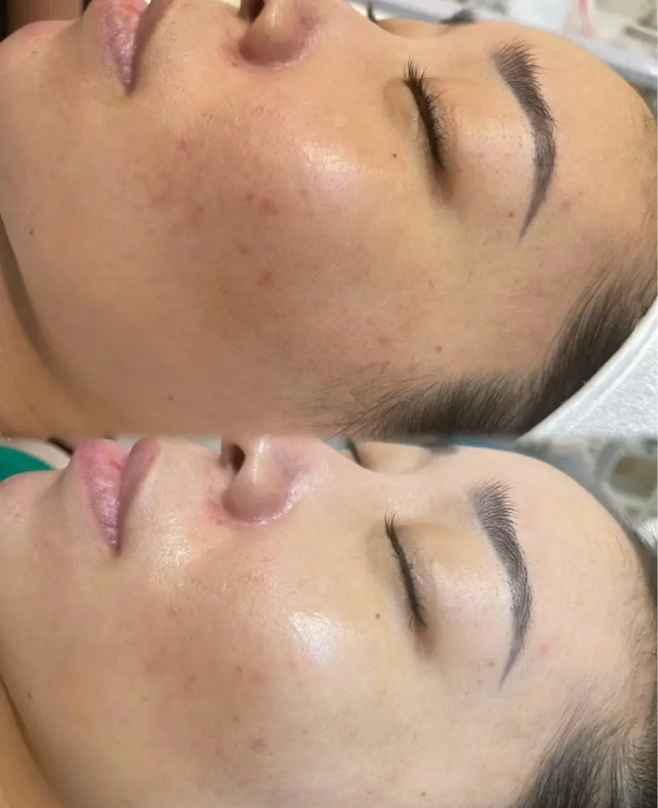 エステ 愛維美水光美肌専門店 メンズレディースokのエステ・リラクイメージ
