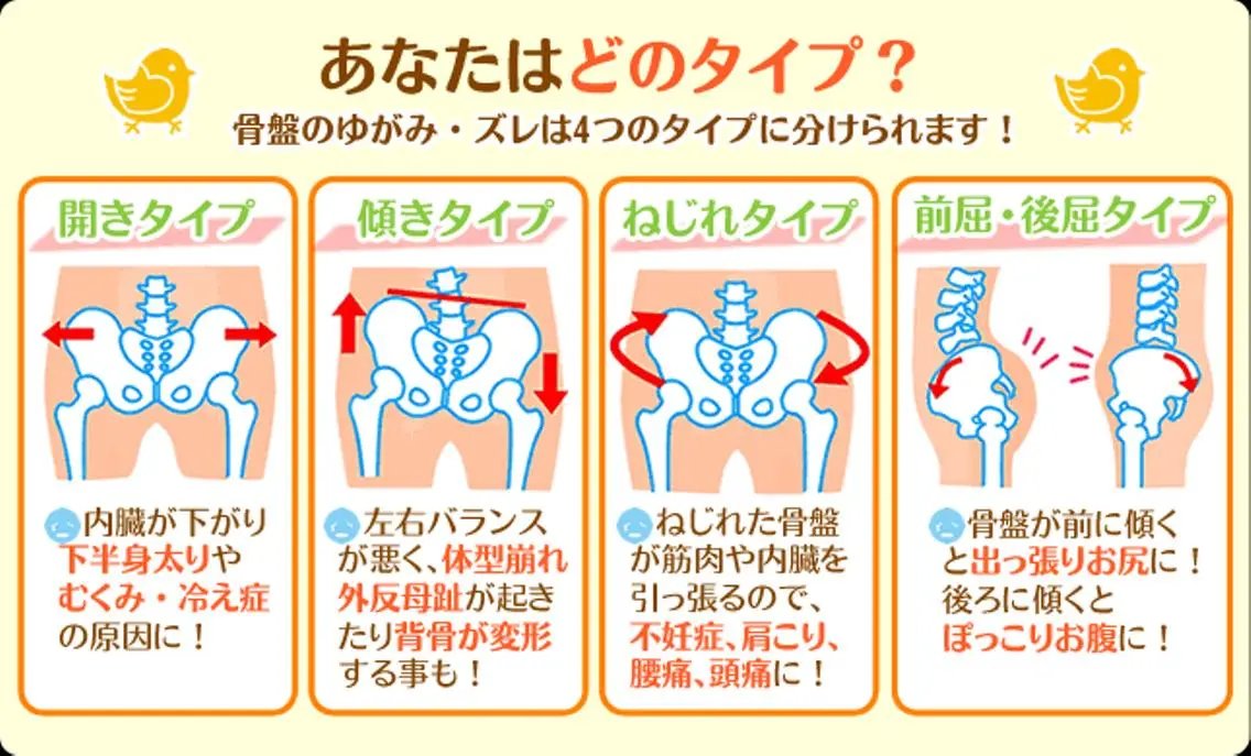 骨盤矯正の写真