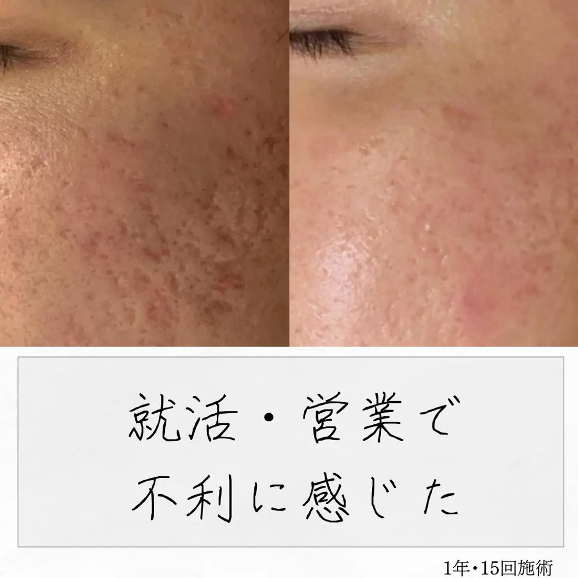 ニキビ経験者が施術 する専門サロン🌻のエステ・リラクイメージ