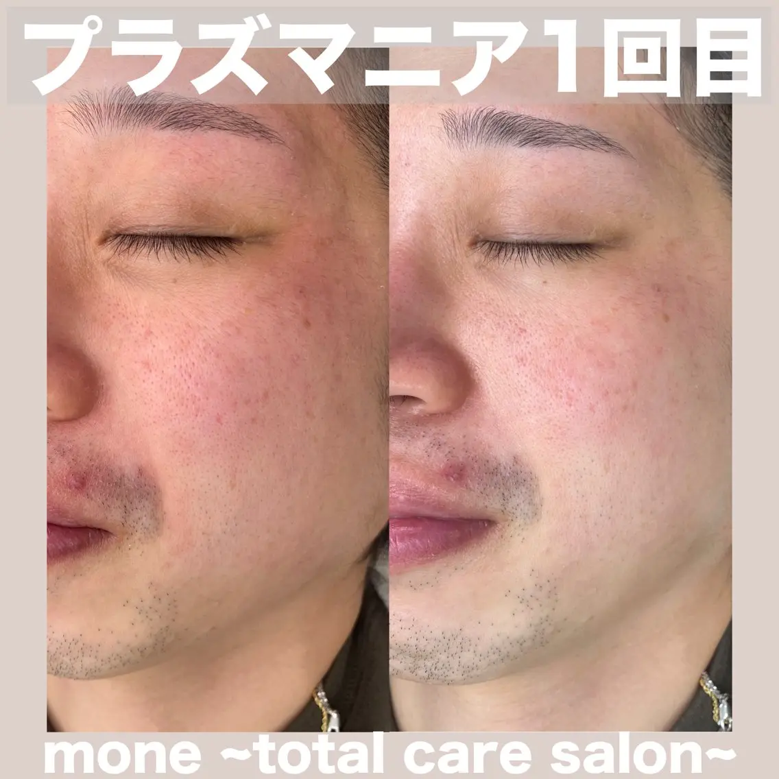 エステ mone (モーネ)のエステ・リラクイメージ