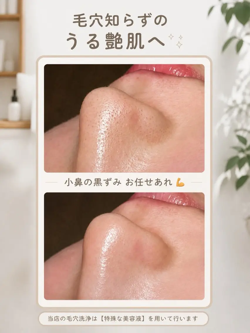 《肌育》一度の施術で変化◎韓国艶肌フェイシャル ¥8,800 → ¥4,500ハイドロ毛穴洗浄+ヒト幹細胞の写真