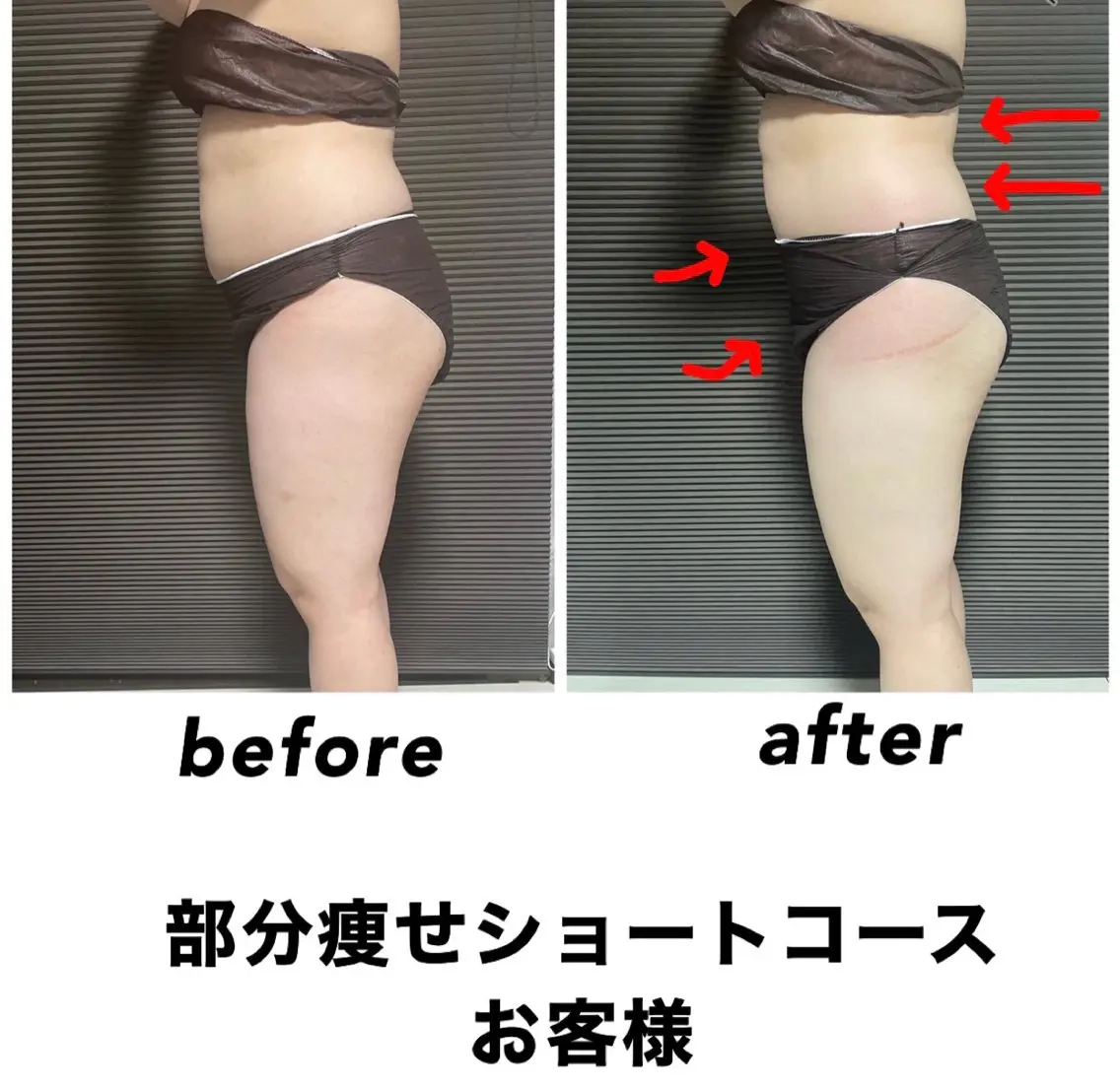 ネイル・エステサロン UILANIのエステ・リラクイメージ