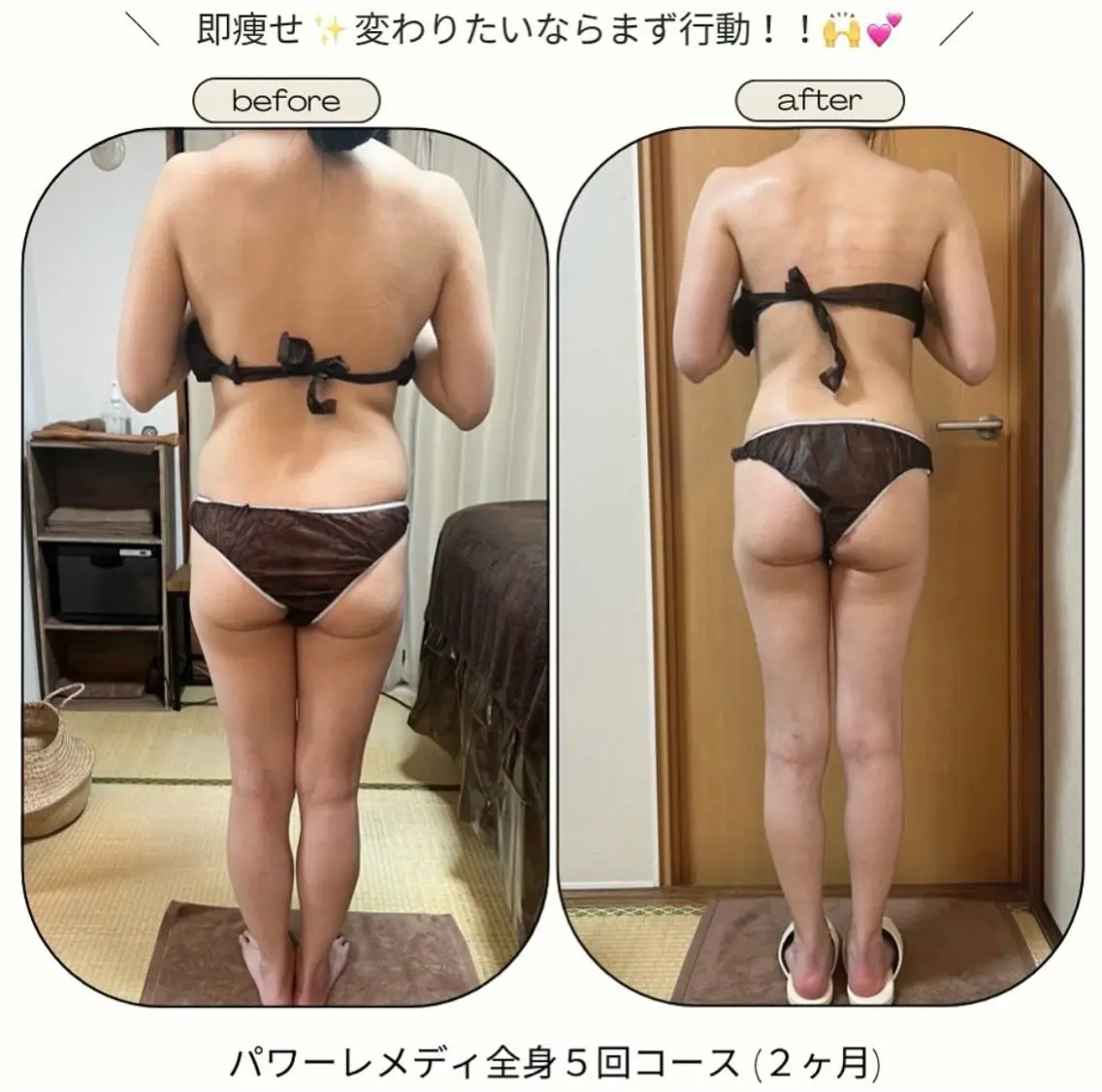 《本気痩せ×疲労改善 》  BILOOPのエステ・リラクイメージ