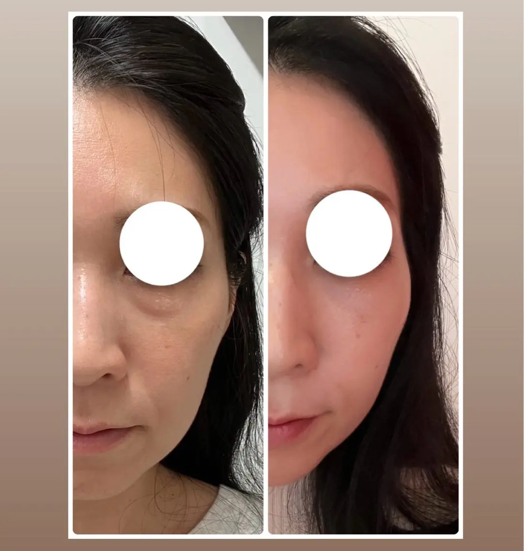 ■ 美ﾎﾞﾃﾞｨﾘﾘｰｽ➕頭小顔美骨ｺﾙｷﾞ 45分Massage to make your face smallerの写真