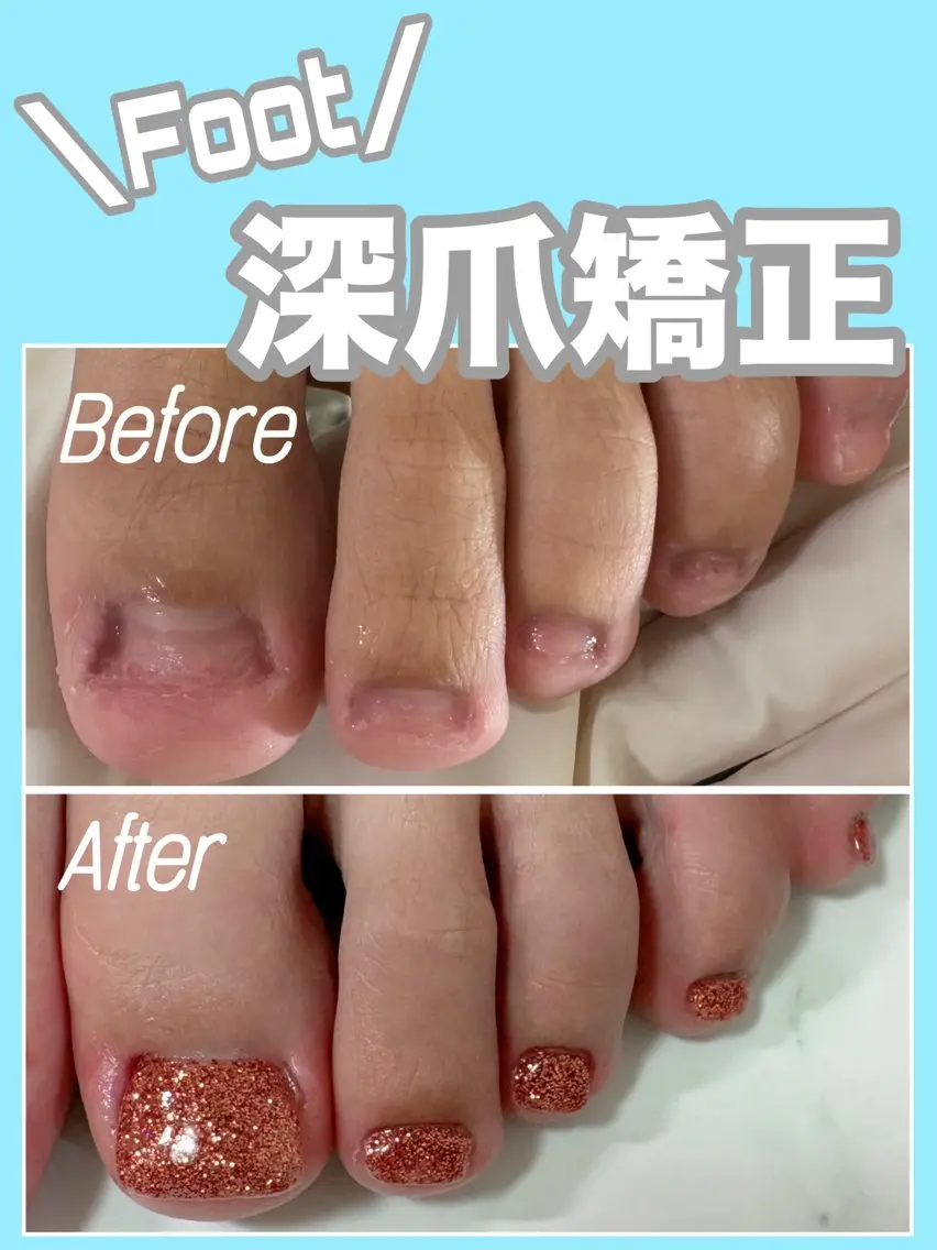ネイル アートネイル 長さ出し ジェルネイル フットネイル nail salon petillantのネイルデザイン