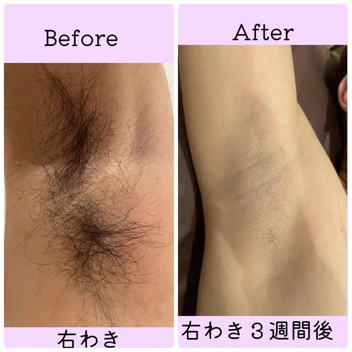 脱毛サロン viel gluckのエステ・リラクイメージ