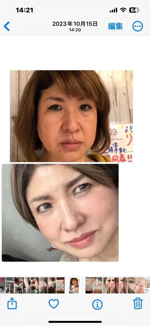 毛穴小顔・痩身サロン メイク・ド・ミュウのその他イメージ