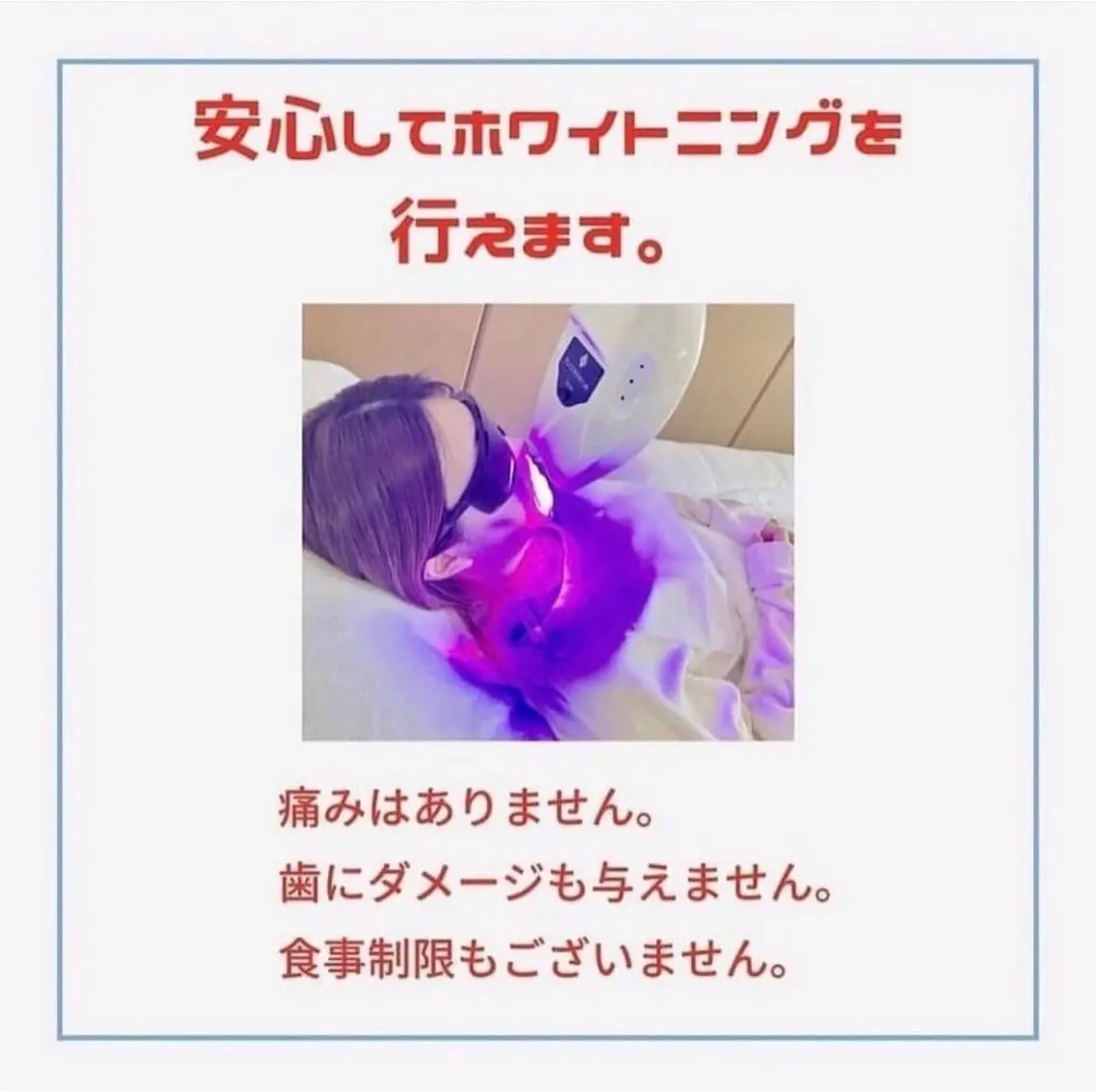 ホワイトニング ショップ伊丹店のその他イメージ