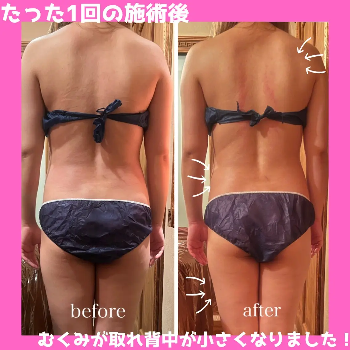 痩身&美肌サロン 堀米✨のその他イメージ