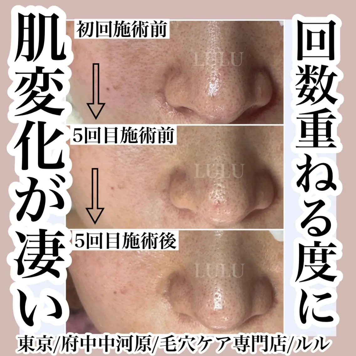 その他 LULU ルルのエステ・リラクイメージ