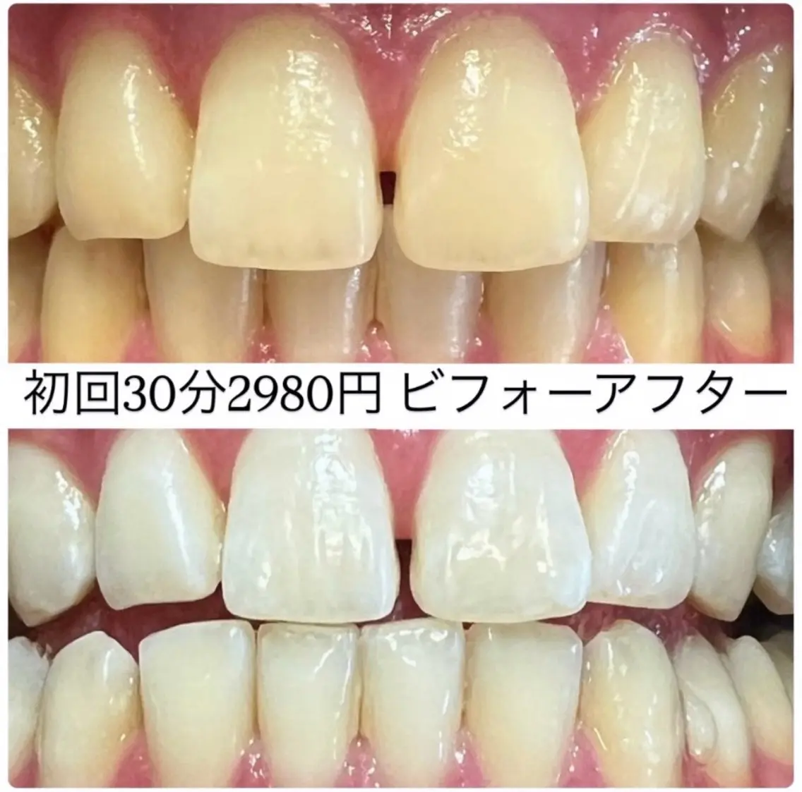 その他 ホワイトニングルーム 横浜店のその他イメージ