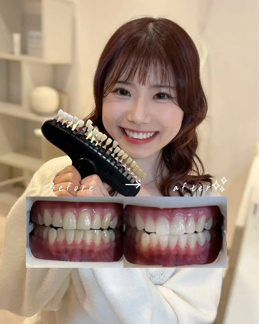 歯科提携エラン ホワイトニング一社店のその他イメージ