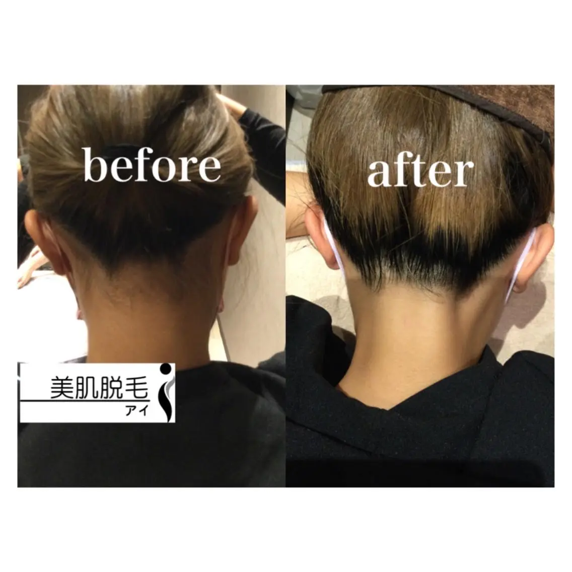 美肌脱毛i |泉大津のエステ・リラクイメージ