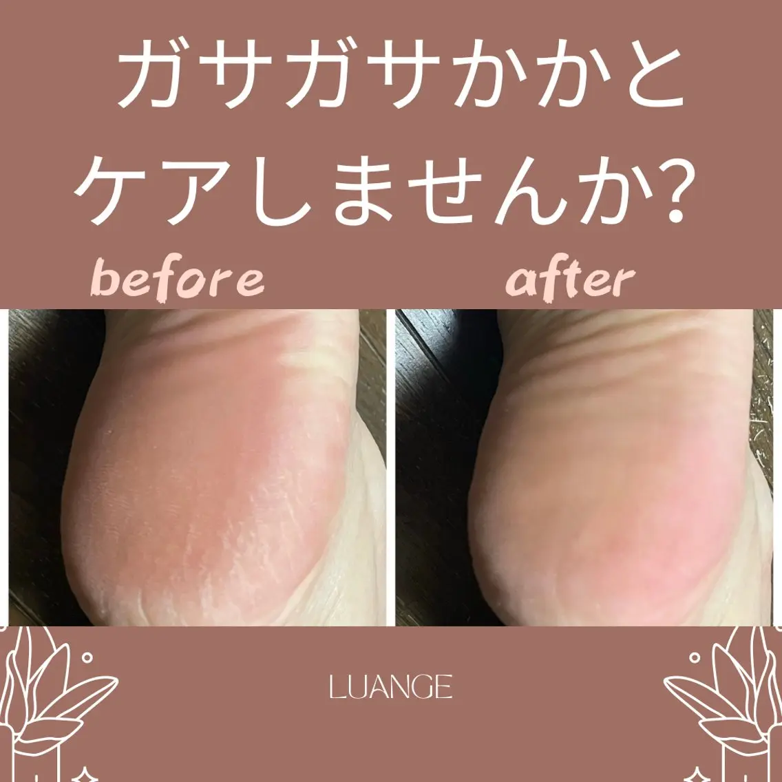 メンズ キッズ エステ 美肌脱毛エステサロン Luangeのエステ・リラクイメージ