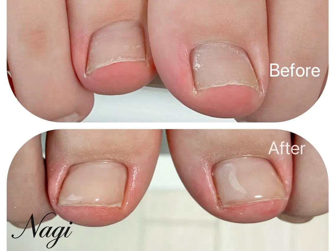 ネイル フットネイル Nagi Nail 本山のネイルデザイン