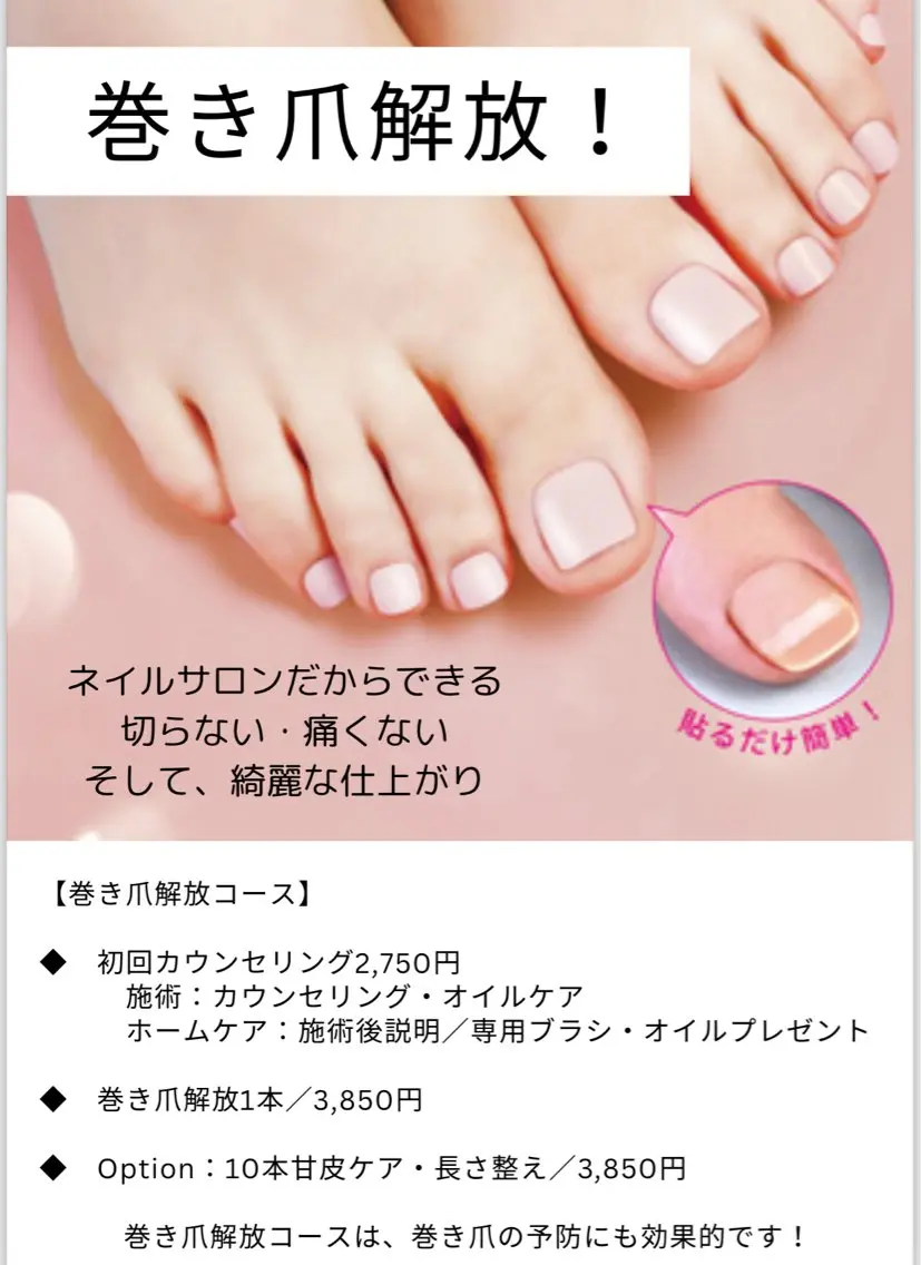 巻爪解放&爪ケア(足浴&マッサージ付き)の写真