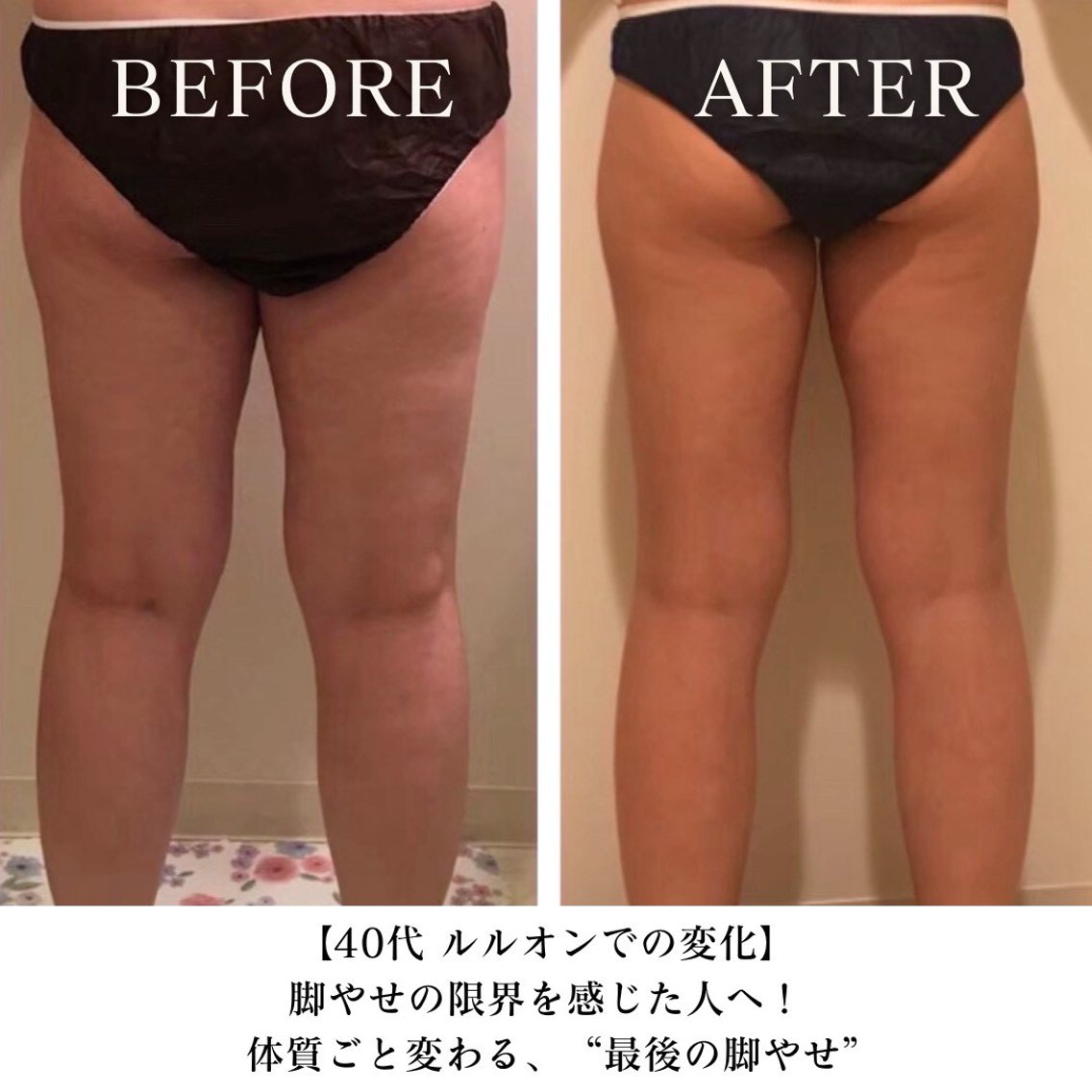 エステ リラク YOSAPARK urara大井町のエステ・リラクイメージ