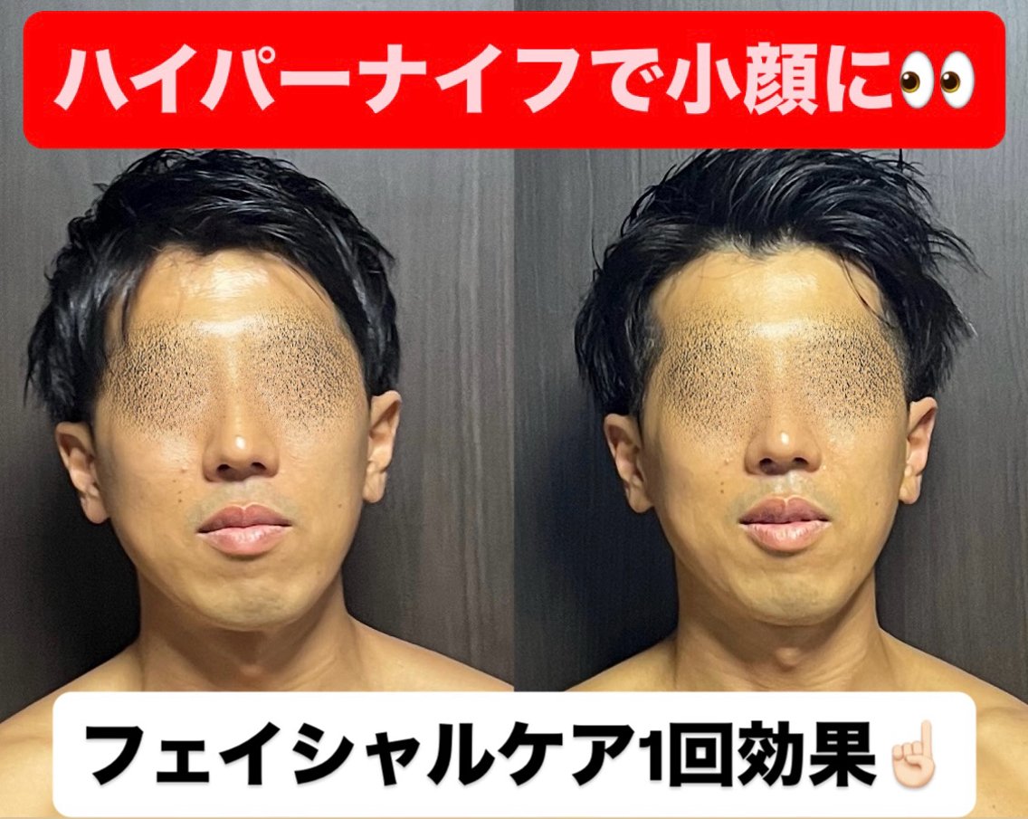 メンズ ハイパーナイフ専門 熊田陽子のエステ・リラクイメージ