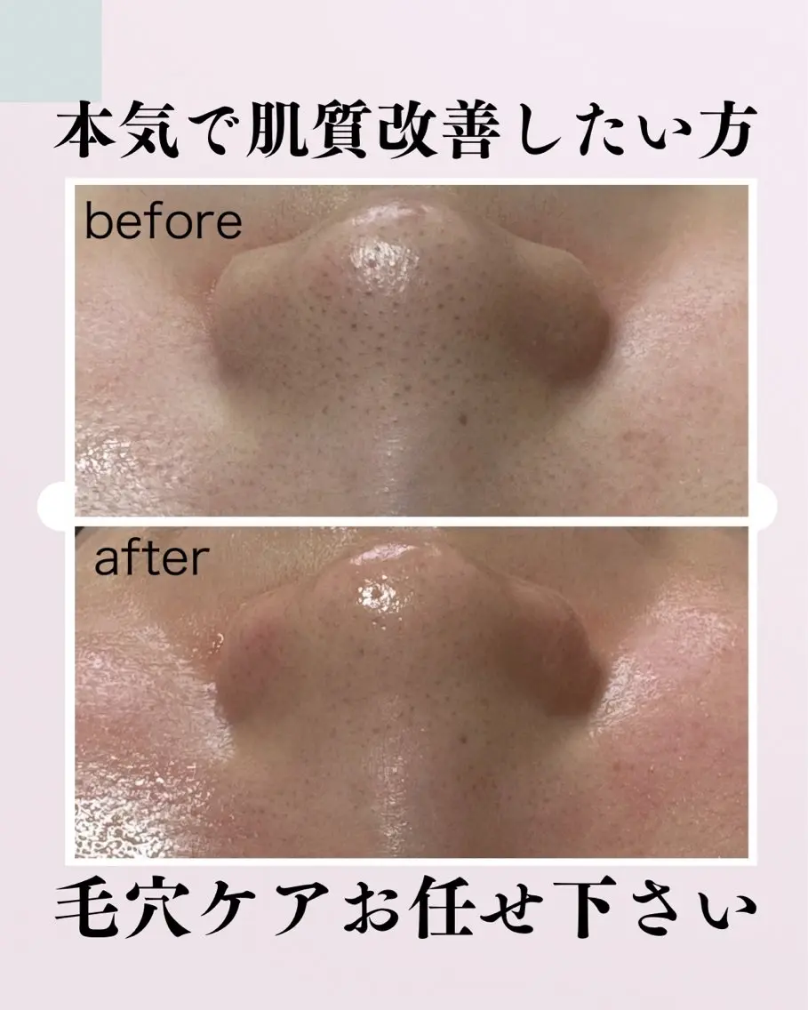 エステ 肌質改善サロン facialmoonのエステ・リラクイメージ