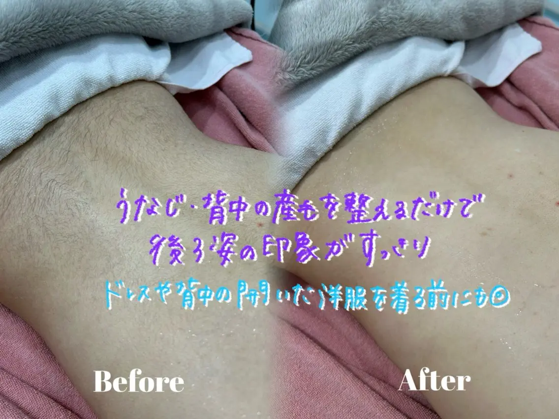 その他 🫧美しい素肌へ🫧 今成柚乃のその他イメージ