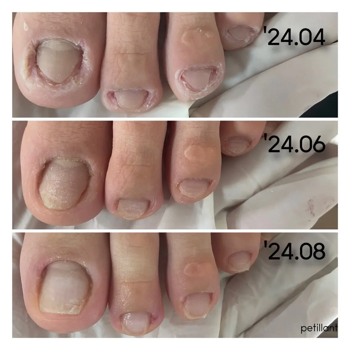 ネイル 卒業式 nail salon petillantのネイルデザイン