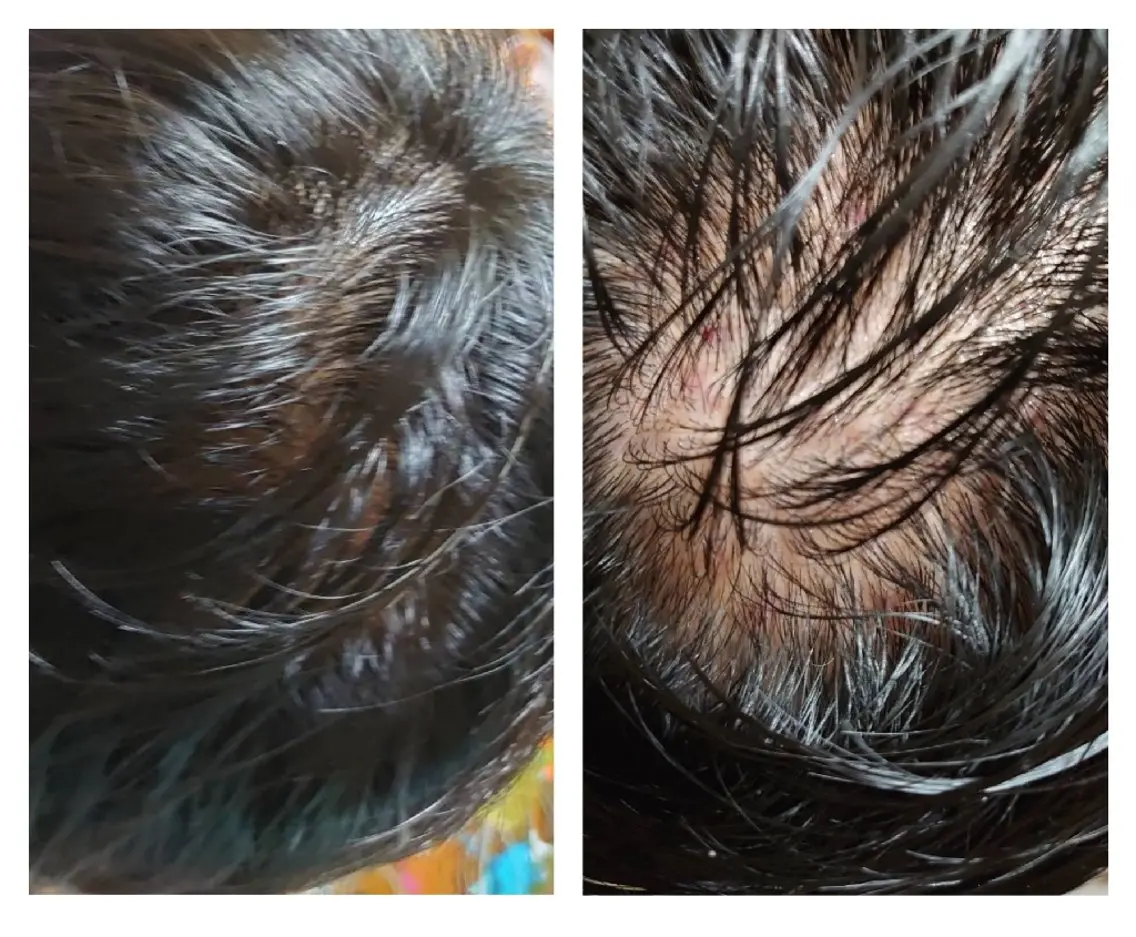 ヘア悩み改善メニューの写真