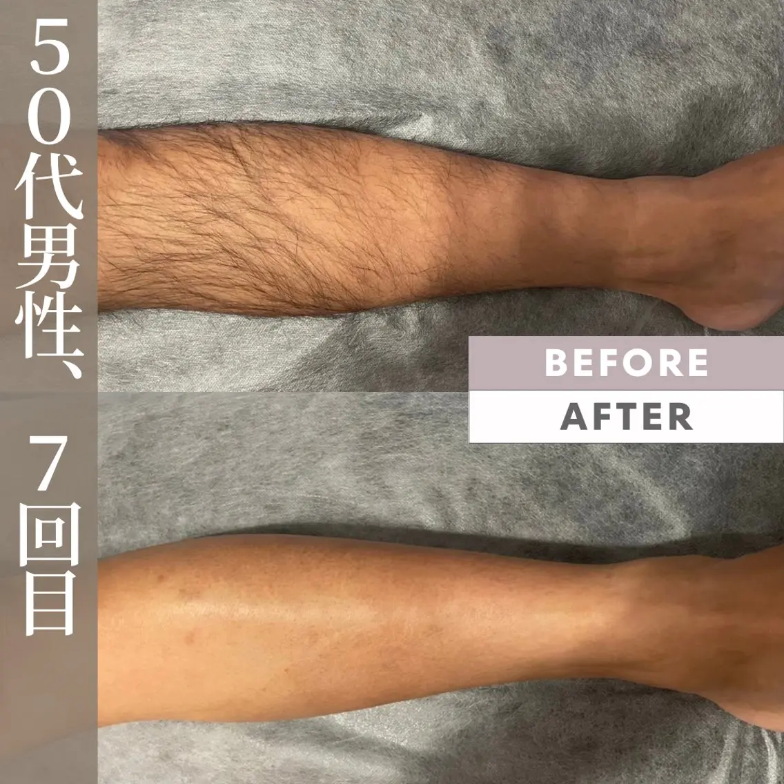 脱毛 GANZAN yukariのエステ・リラクイメージ