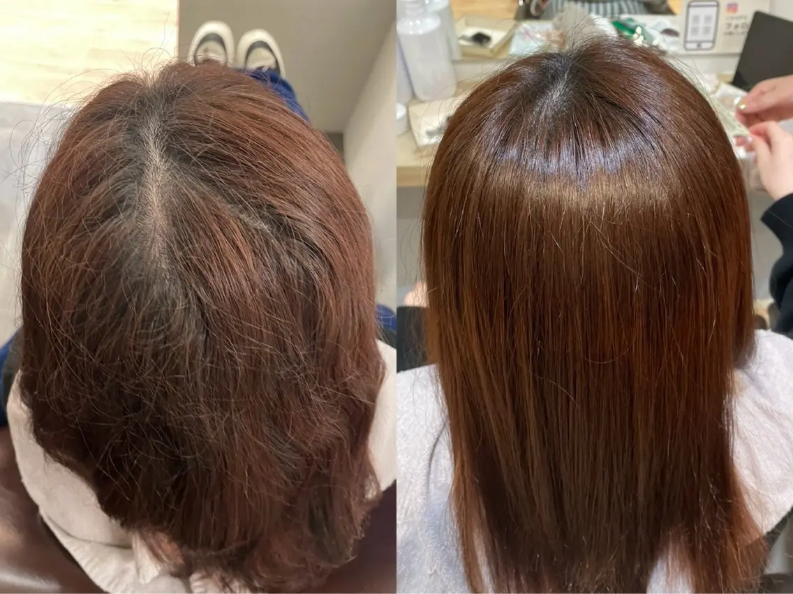 2回目限定✨️【バイカルテ】毛髪再生+髪質改善トリートメント🌳🫧自宅でもお手入れできるホームケア付き💝💫の写真
