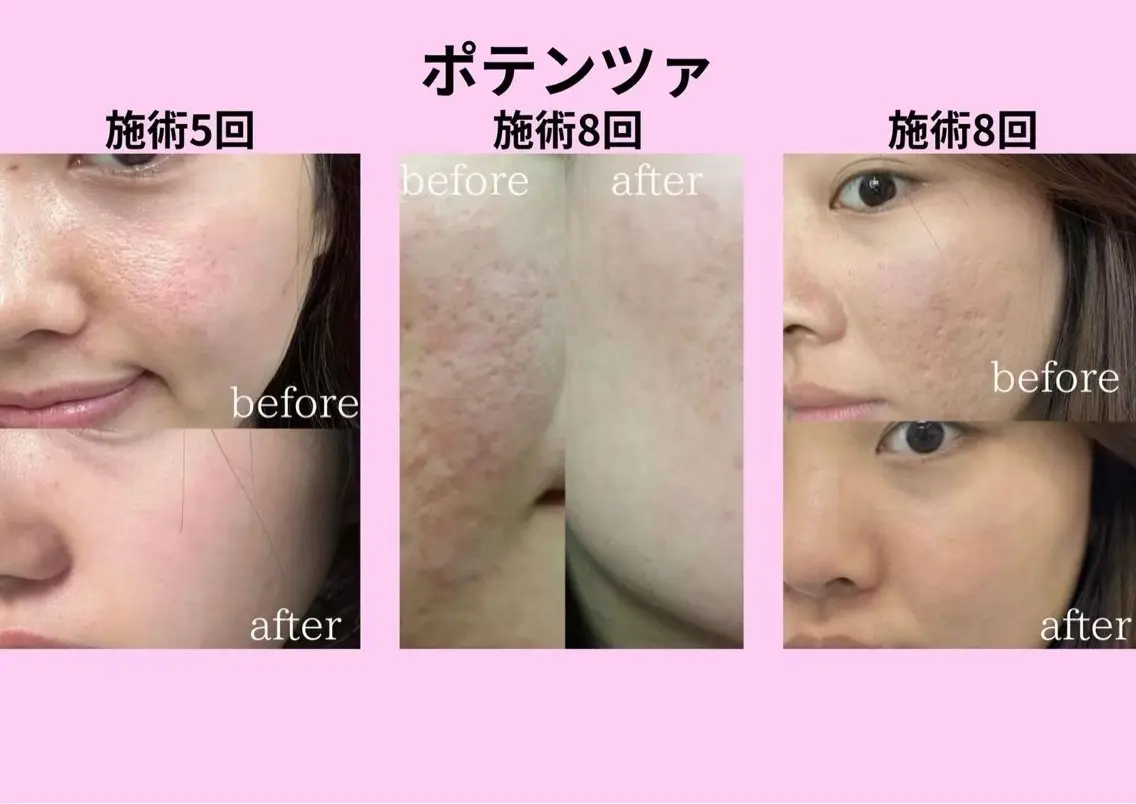 マツエク・マツパ 愛維美水光専門店 川崎彩鳳のエステ・リラクイメージ
