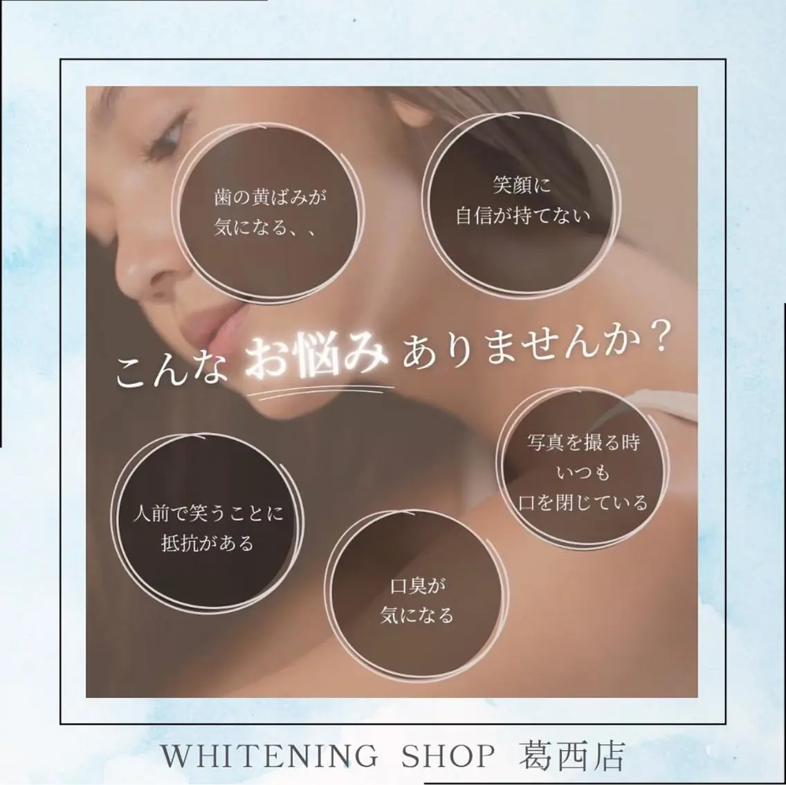 メンズ その他 ホワイトニング ショップ葛西店のその他イメージ