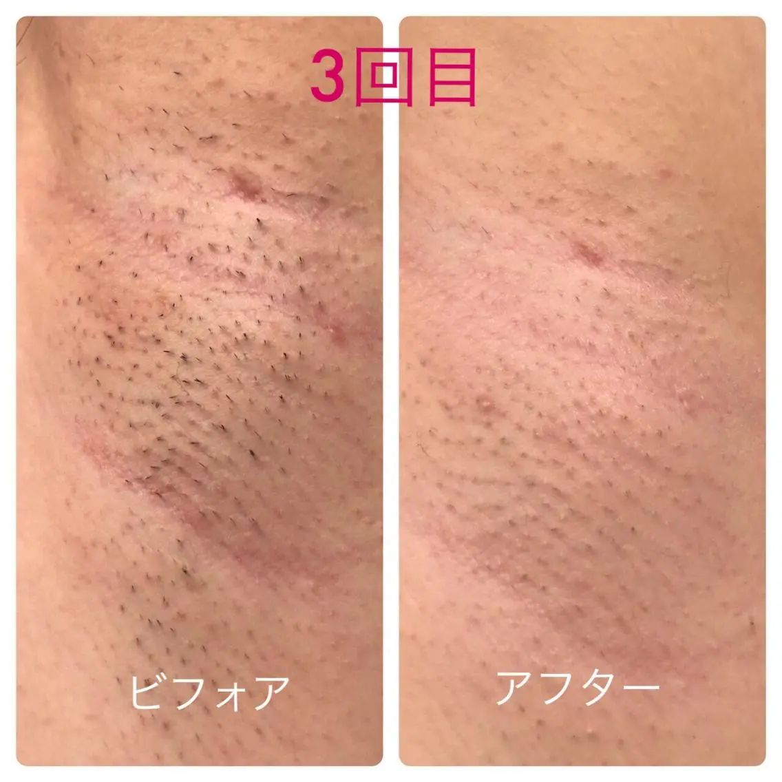 オンダリフト小顔･ ワックス脱毛×光脱毛のエステ・リラクイメージ