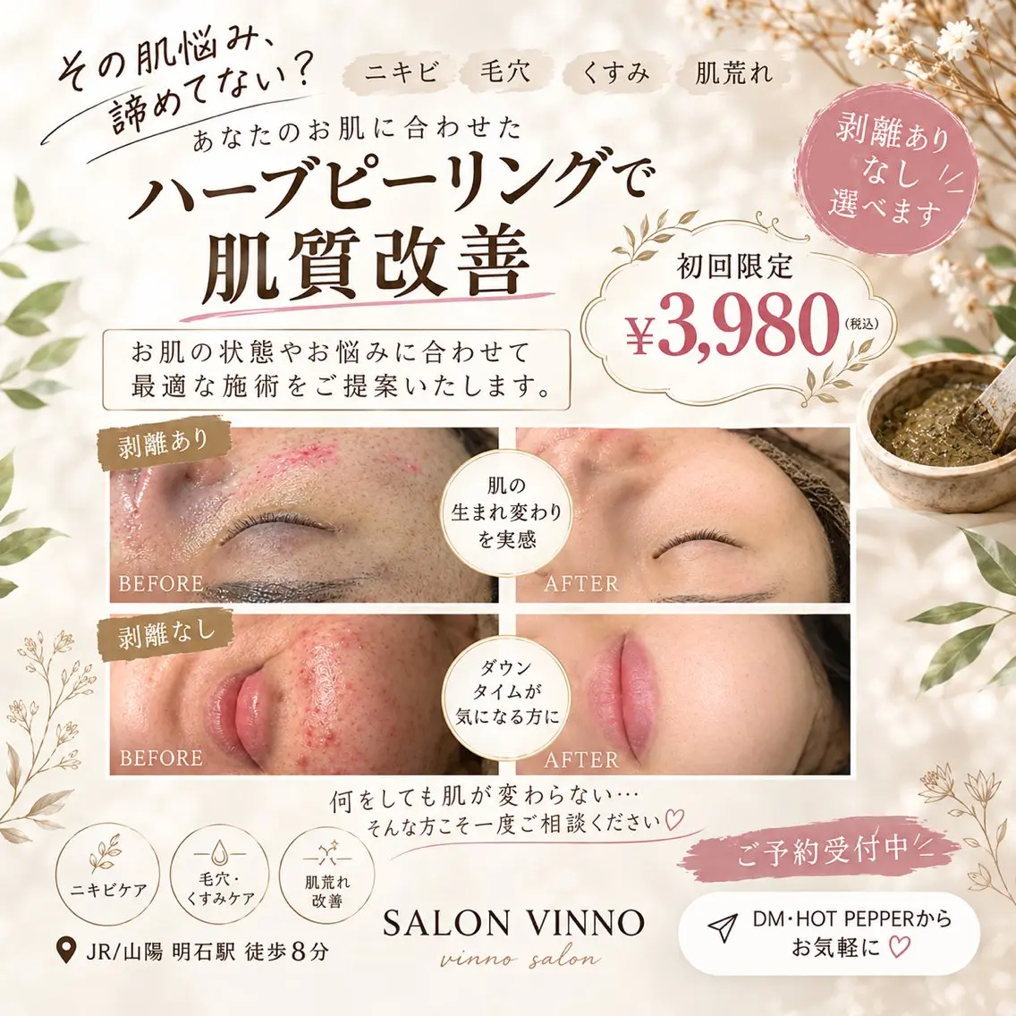 【初回限定】剥離なしハーブピーリング🌿の写真