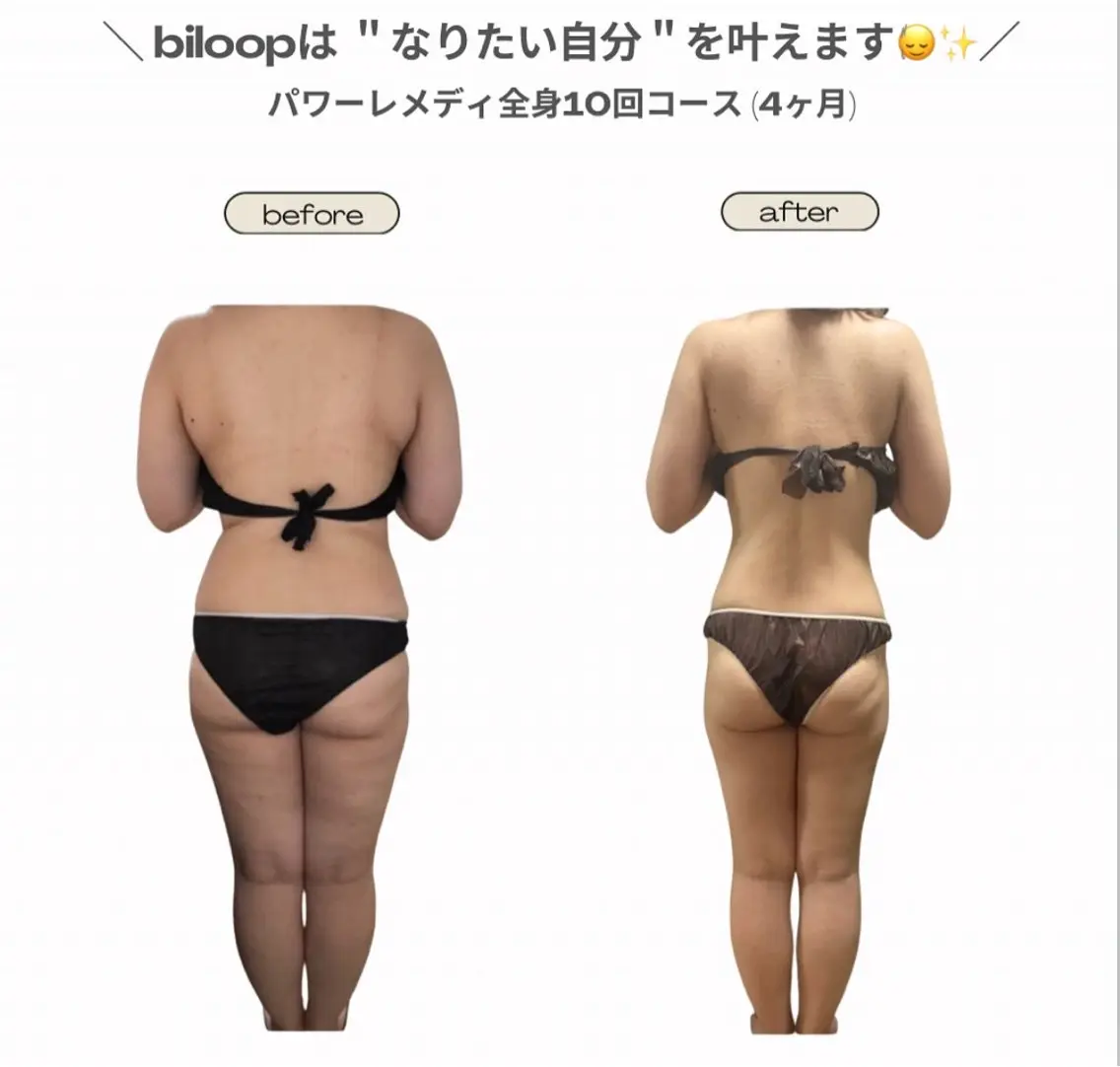 エステ リラク 《本気痩せ×疲労改善 》  BILOOPのエステ・リラクイメージ