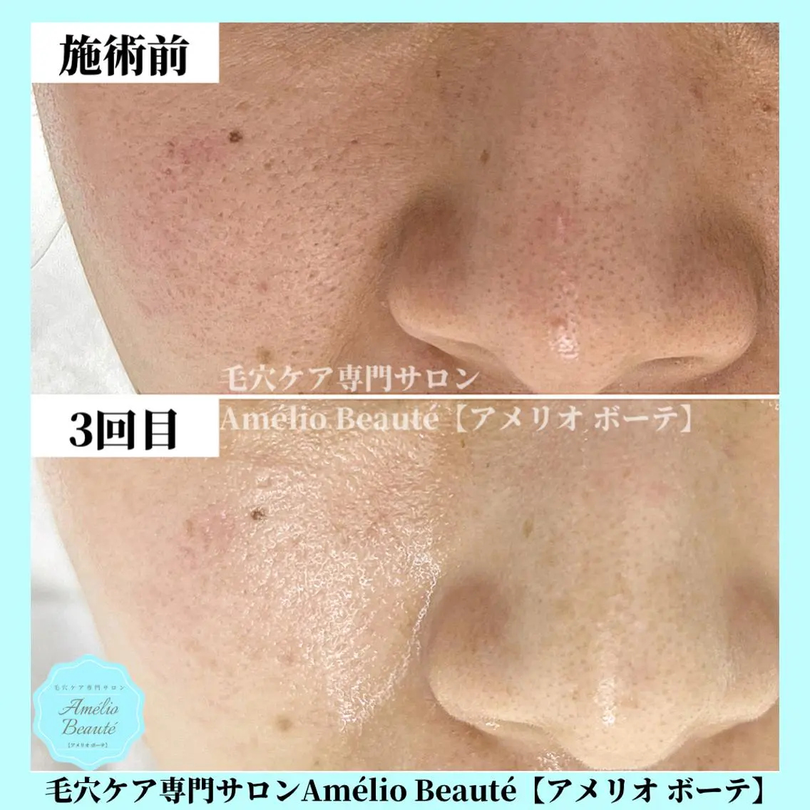 毛穴ケア専門サロン アメリオボーテのその他イメージ
