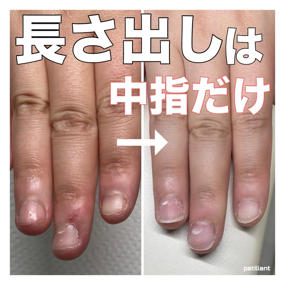 ネイル 長さ出し 卒業式 nail salon petillantのネイルデザイン