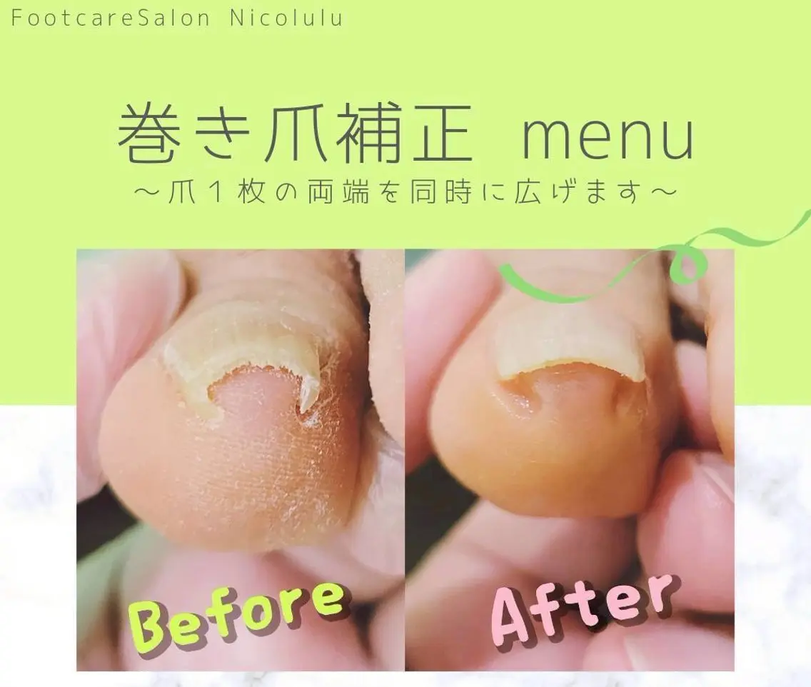 メンズ Nicolulu 金沢店のエステ・リラクイメージ