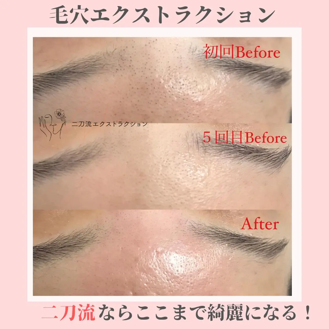 ピーリング専門店 Belluteのエステ・リラクイメージ