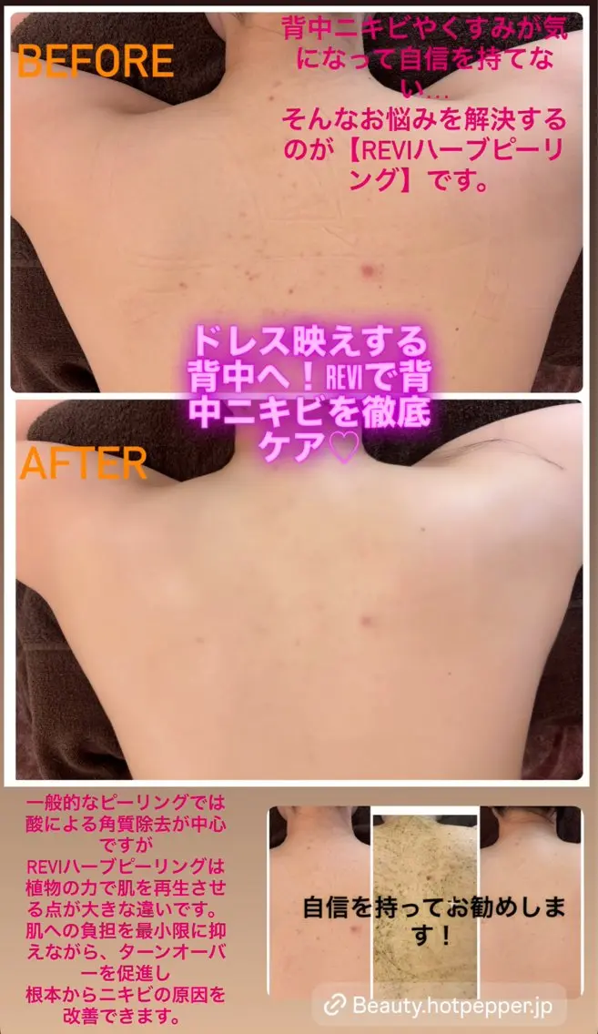 ハーブピーリング専門 毛穴洗浄❤️眉waxのエステ・リラクイメージ