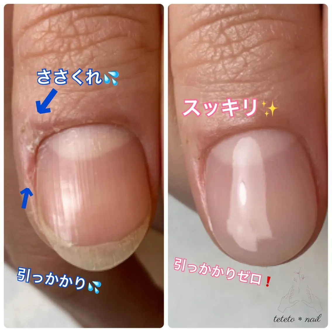 ネイル ハンドネイル テテト *ネイルのネイルデザイン