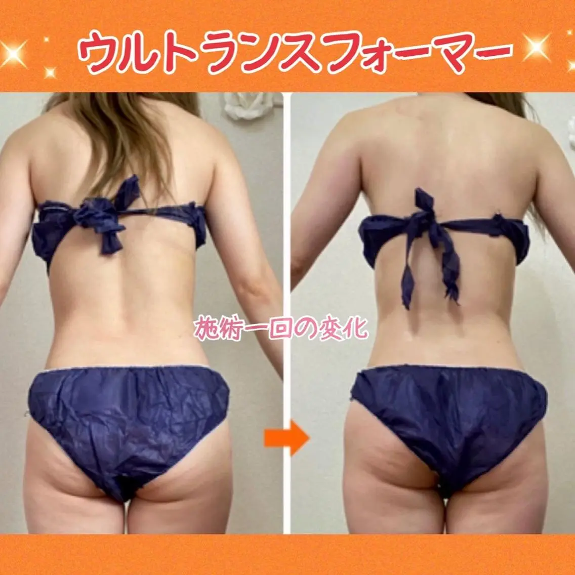 ショート カラー パーマ ヘアアレンジ メンズ キッズ ネイル マツエク・マツパ エステ リラク 痩身&ボディ 結果出し🌟丹野のエステ・リラクイメージ