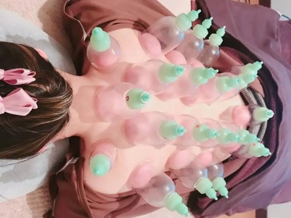 全身カッピングトリートメント 60分の写真