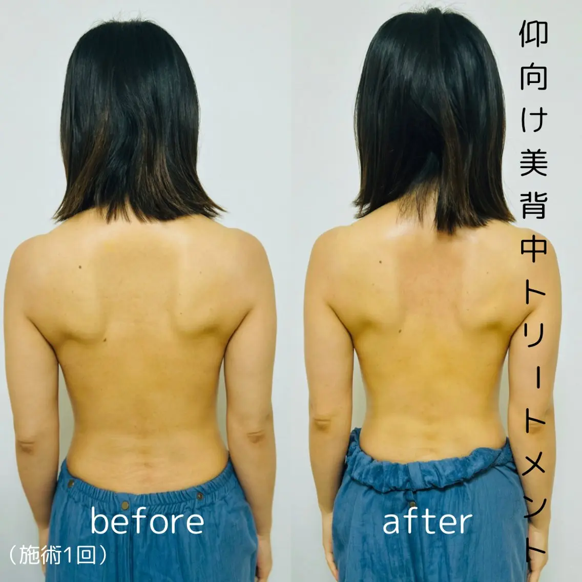 ドライヘッド+仰向け美背中トリートメント60分​〜​の写真