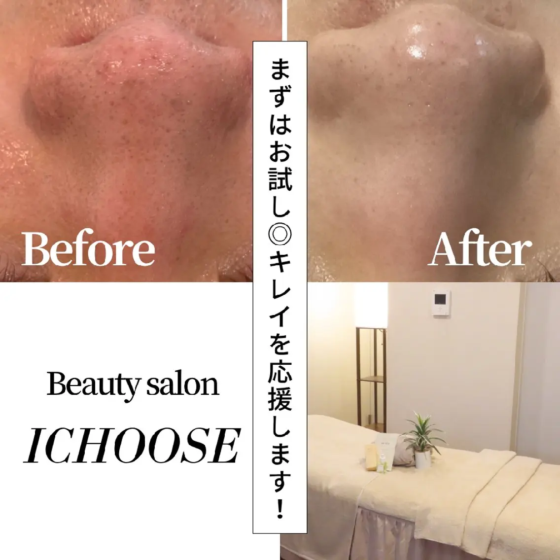 エステ CHOOSE/島田 根本改善/代々木上原のエステ・リラクイメージ