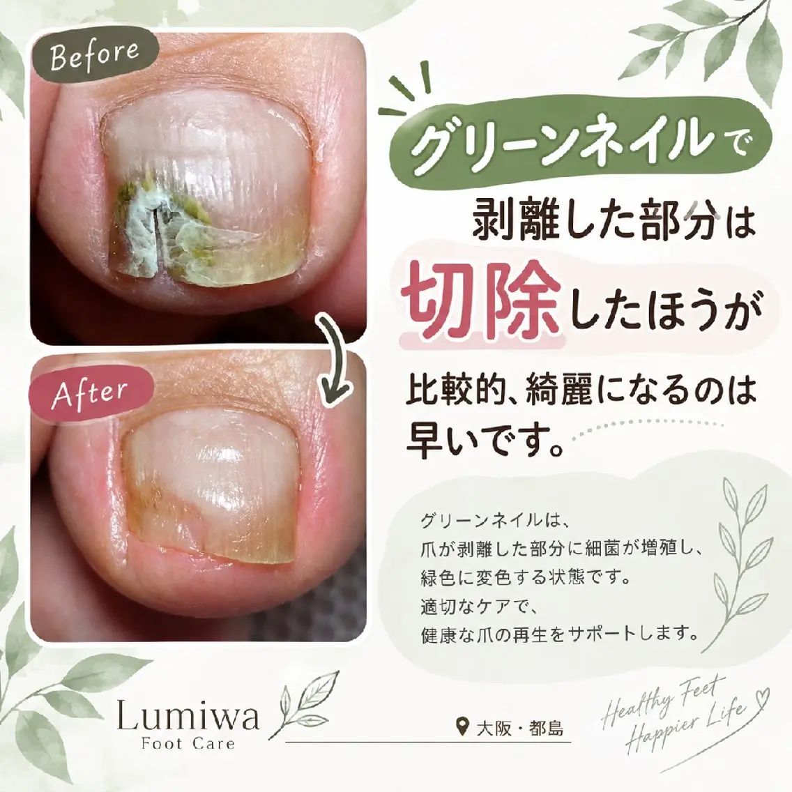 ネイル グリーン ときおか みわのネイルデザイン