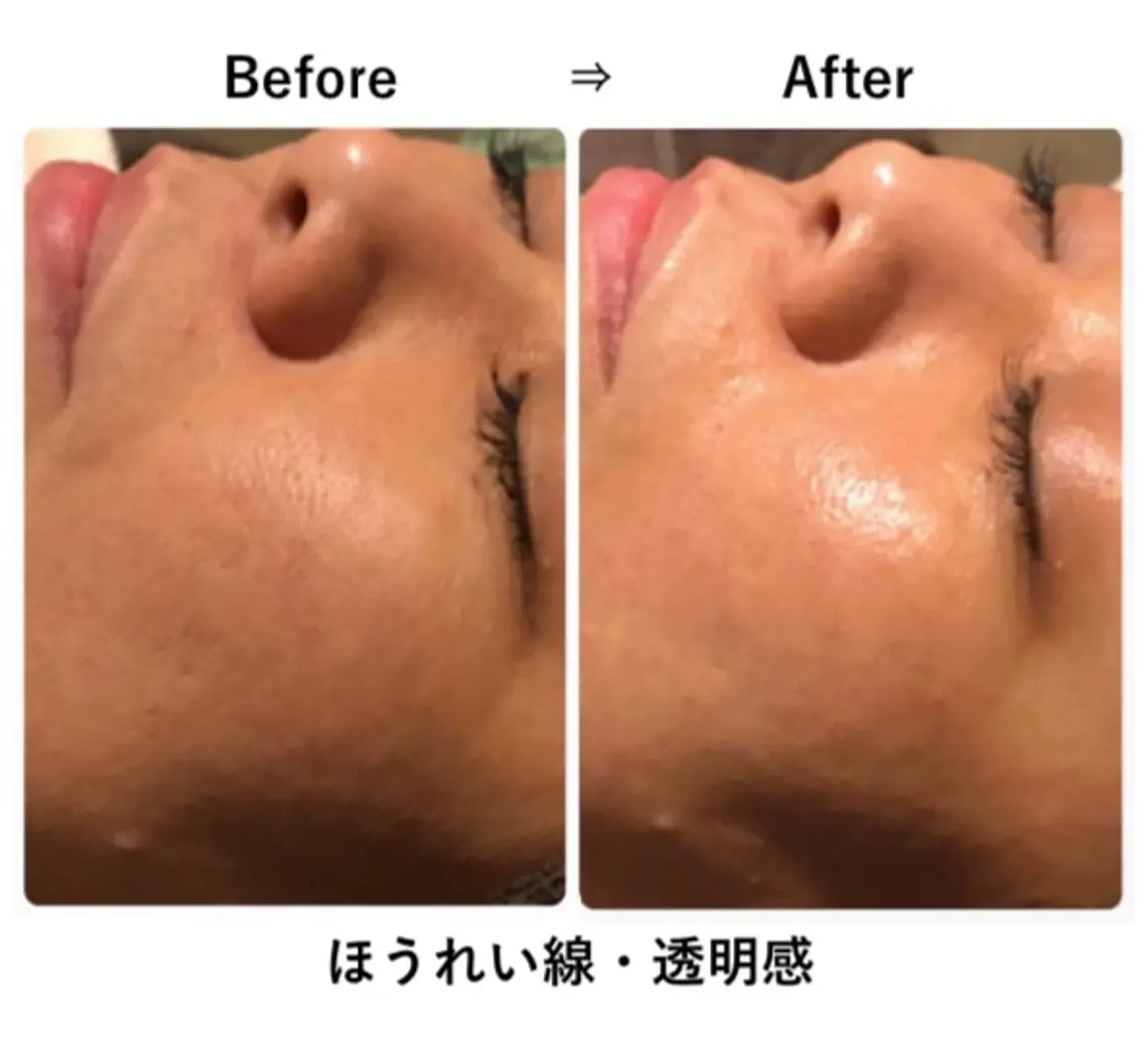 エステ solua Ayamiのマツエク・マツパデザイン