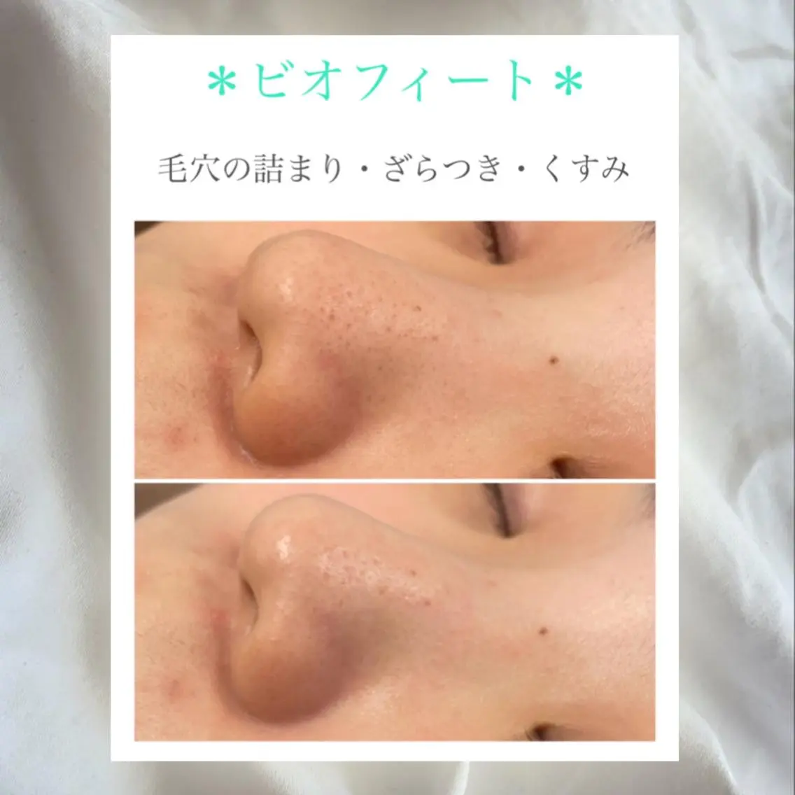 ショート カラー パーマ ヘアアレンジ メンズ キッズ ネイル マツエク・マツパ アイブロウ ブルー 赤色 エステ リラク 🦋美肌サロン. maho🦋のエステ・リラクイメージ